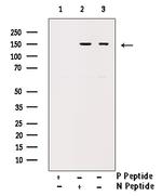 Phospho-ErbB2 (HER-2) (Tyr1112) Antibody in Western Blot (WB)