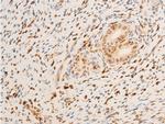 Phospho-TrkA (Tyr680, Tyr681) Antibody in Immunohistochemistry (Paraffin) (IHC (P))