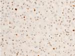 Phospho-TrkA (Tyr680, Tyr681) Antibody in Immunohistochemistry (Paraffin) (IHC (P))