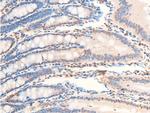 Phospho-TrkA (Tyr680, Tyr681) Antibody in Immunohistochemistry (Paraffin) (IHC (P))