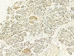 Phospho-p53 (Ser15) Antibody in Immunohistochemistry (Paraffin) (IHC (P))