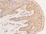 Phospho-p53 (Ser15) Antibody in Immunohistochemistry (Paraffin) (IHC (P))