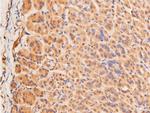 Phospho-p53 (Ser15) Antibody in Immunohistochemistry (Paraffin) (IHC (P))