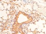 Phospho-p53 (Ser15) Antibody in Immunohistochemistry (Paraffin) (IHC (P))