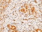 Phospho-c-Jun (Ser243) Antibody in Immunohistochemistry (Paraffin) (IHC (P))