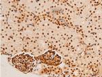 Phospho-c-Jun (Thr91) Antibody in Immunohistochemistry (Paraffin) (IHC (P))