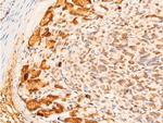 Phospho-c-Jun (Tyr170) Antibody in Immunohistochemistry (Paraffin) (IHC (P))