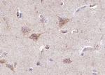 Phospho-INSR (Tyr1355) Antibody in Immunohistochemistry (Paraffin) (IHC (P))