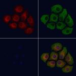 Phospho-INSR (Tyr1361) Antibody in Immunocytochemistry (ICC/IF)