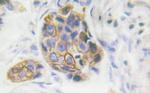 Phospho-INSR (Tyr1361) Antibody in Immunohistochemistry (Paraffin) (IHC (P))