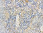 Phospho-Fyn (Tyr531) Antibody in Immunohistochemistry (Paraffin) (IHC (P))