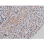 Phospho-Fyn (Tyr531) Antibody in Immunohistochemistry (Paraffin) (IHC (P))