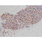 Phospho-Fyn (Tyr531) Antibody in Immunohistochemistry (Paraffin) (IHC (P))