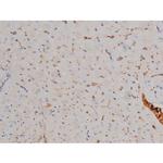 Phospho-Fyn (Tyr531) Antibody in Immunohistochemistry (Paraffin) (IHC (P))