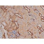 Phospho-Fyn (Tyr531) Antibody in Immunohistochemistry (Paraffin) (IHC (P))