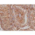 Phospho-Fyn (Tyr531) Antibody in Immunohistochemistry (Paraffin) (IHC (P))