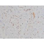 Phospho-Fyn (Tyr531) Antibody in Immunohistochemistry (Paraffin) (IHC (P))