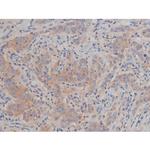 Phospho-Fyn (Tyr531) Antibody in Immunohistochemistry (Paraffin) (IHC (P))