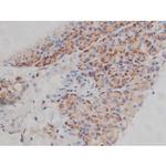 Phospho-Fyn (Tyr531) Antibody in Immunohistochemistry (Paraffin) (IHC (P))