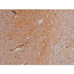 Phospho-Fyn (Tyr531) Antibody in Immunohistochemistry (Paraffin) (IHC (P))