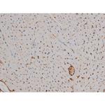 Phospho-Fyn (Tyr531) Antibody in Immunohistochemistry (Paraffin) (IHC (P))