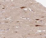 Phospho-Rb (Ser795) Antibody in Immunohistochemistry (Paraffin) (IHC (P))