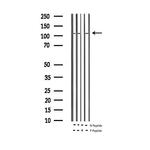 Phospho-Rb (Ser795) Antibody in Western Blot (WB)