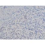 Phospho-NPM1 (Thr199) Antibody in Immunohistochemistry (Paraffin) (IHC (P))