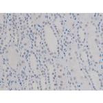 Phospho-NPM1 (Thr199) Antibody in Immunohistochemistry (Paraffin) (IHC (P))