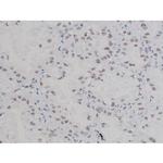 Phospho-NPM1 (Thr199) Antibody in Immunohistochemistry (Paraffin) (IHC (P))