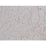 Phospho-NPM1 (Thr199) Antibody in Immunohistochemistry (Paraffin) (IHC (P))