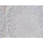 Phospho-NPM1 (Thr199) Antibody in Immunohistochemistry (Paraffin) (IHC (P))