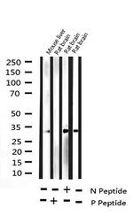 Phospho-NPM1 (Thr199) Antibody in Western Blot (WB)