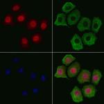 Phospho-Tyrosine Hydroxylase (Ser31) Antibody in Immunocytochemistry (ICC/IF)