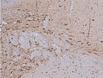 Phospho-Tyrosine Hydroxylase (Ser31) Antibody in Immunohistochemistry (Paraffin) (IHC (P))