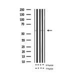 Phospho-Tyrosine Hydroxylase (Ser31) Antibody in Western Blot (WB)