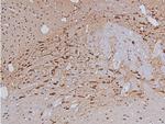 Phospho-Tyrosine Hydroxylase (Ser40) Antibody in Immunohistochemistry (Paraffin) (IHC (P))