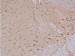 Phospho-Tyrosine Hydroxylase (Ser40) Antibody in Immunohistochemistry (Paraffin) (IHC (P))