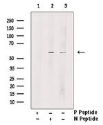 Phospho-Tyrosine Hydroxylase (Ser40) Antibody in Western Blot (WB)