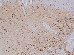 Phospho-Tyrosine Hydroxylase (Ser19) Antibody in Immunohistochemistry (Paraffin) (IHC (P))