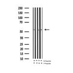 Phospho-Tyrosine Hydroxylase (Ser19) Antibody in Western Blot (WB)