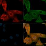 Phospho-beta-2 Adrenergic Receptor (Ser346) Antibody in Immunocytochemistry (ICC/IF)