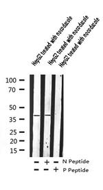 Phospho-beta-2 Adrenergic Receptor (Ser346) Antibody in Western Blot (WB)