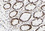 Phospho-hnRNP C (Ser260) Antibody in Immunohistochemistry (Paraffin) (IHC (P))