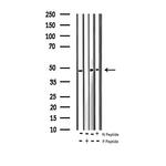 Phospho-hnRNP C (Ser260) Antibody in Western Blot (WB)