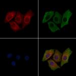 Phospho-RET (Tyr1062) Antibody in Immunocytochemistry (ICC/IF)