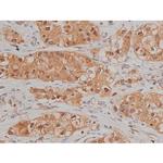 Phospho-SP1 (Thr739) Antibody in Immunohistochemistry (Paraffin) (IHC (P))