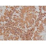 Phospho-SP1 (Thr739) Antibody in Immunohistochemistry (Paraffin) (IHC (P))