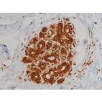 Phospho-IGF1R (Tyr1346) Antibody in Immunohistochemistry (Paraffin) (IHC (P))