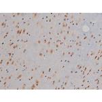 Phospho-IGF1R (Tyr1346) Antibody in Immunohistochemistry (Paraffin) (IHC (P))